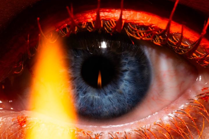 Eye